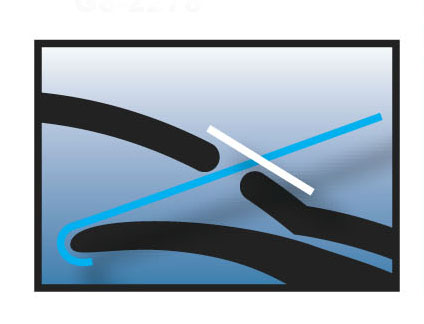 BÜKÜLEBİLİR İRİS EKARTÖR